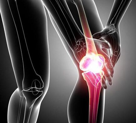 Артриты и артриты поражения коленного сустава